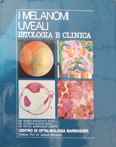 Barraquer,Joaquin. Bonafonte,Royo,Sergio. Muinos Simon,Alfredo. - I melanomi uveali. Istologia e clinica.