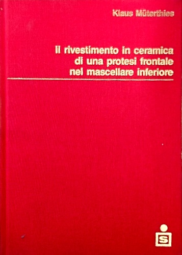 Il rivestimento in ceramica di una protesi frontale nel mascellare inferiore.