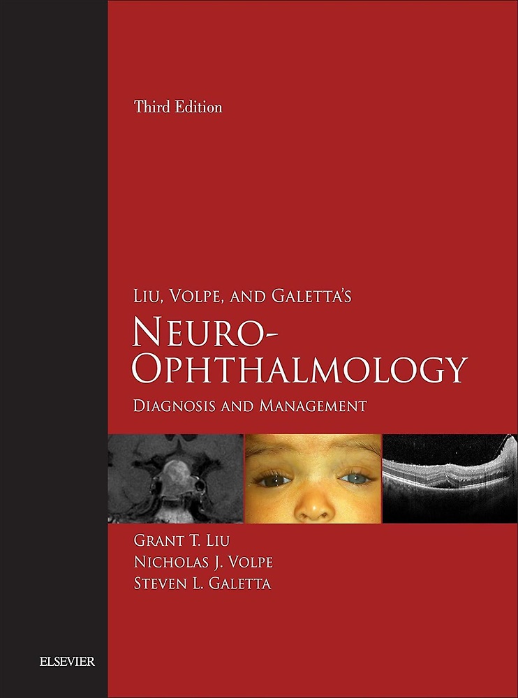 9780323340441-Liu, Volpe, and Galetta’s Neuro-Ophthalmology, Diagnosis and Management.