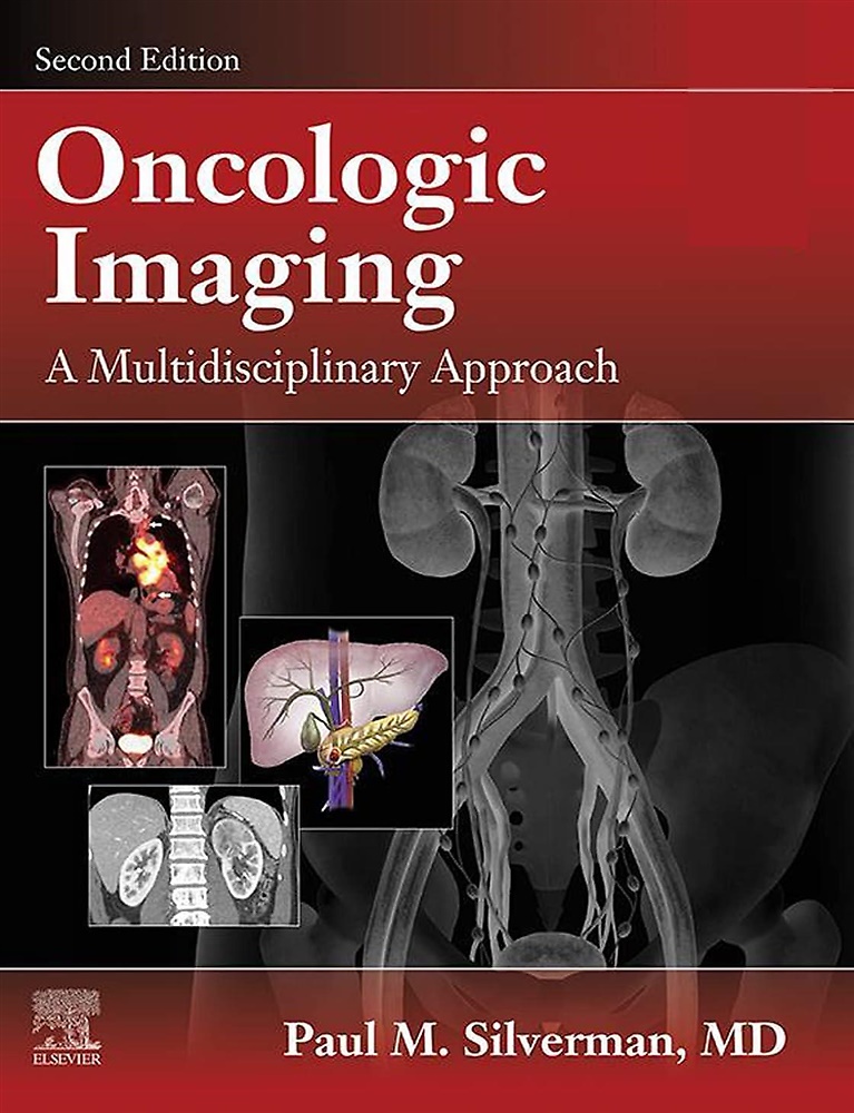 9780323695381-Oncologic Imaging: A Multidisciplinary Approach.