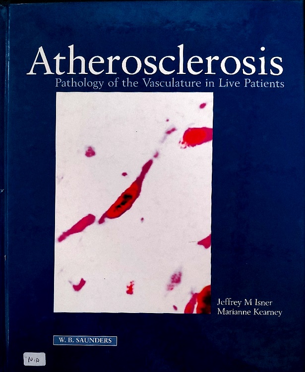 9780702019272-Atherosclerosis.