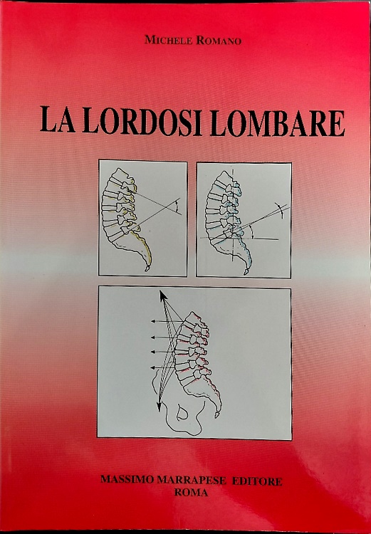 La lordosi lombare.