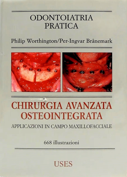 9788802050270-Chirurgia avanzata osteointegrata - Applicazioni in campo maxillofacciale.