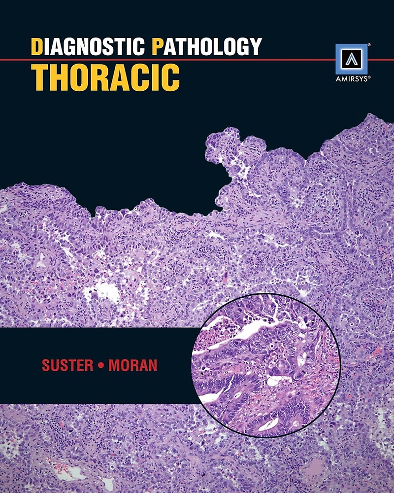9781931884495-Diagnostic Pathology: Thoracic.