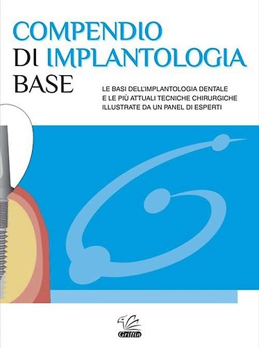 9788890380754-Compendio di implantologia base.